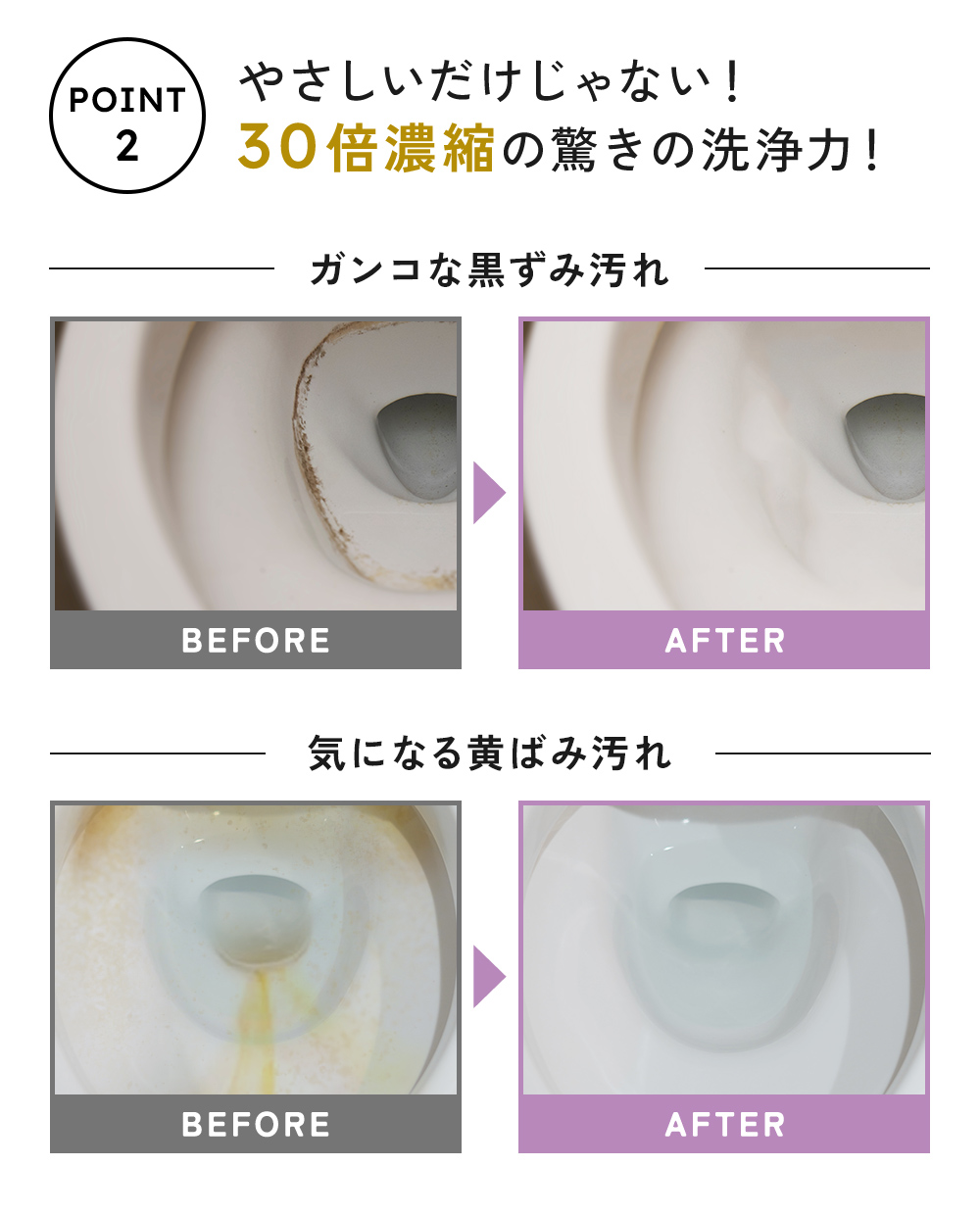 やさしいだけじゃない!30倍濃縮の驚きの洗浄力で、便器のガンコな黒ずみ汚れや、気になる黄ばみ汚れも。